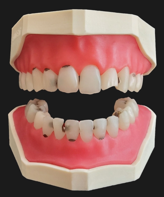 Restorative Dentistry