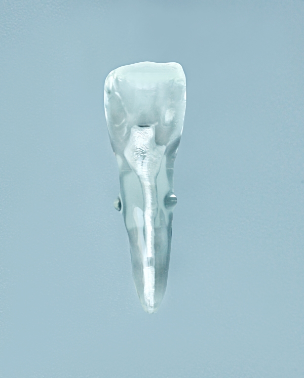 EndoPrep® One Tooth