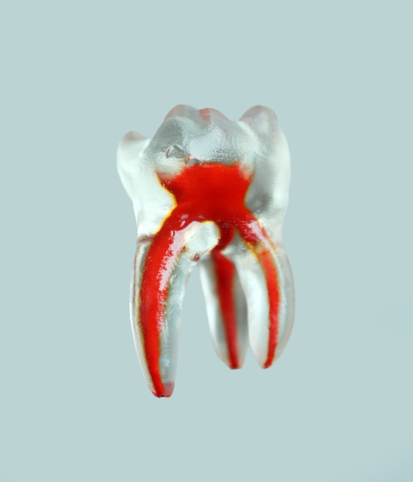 PedoPrep® One Tooth