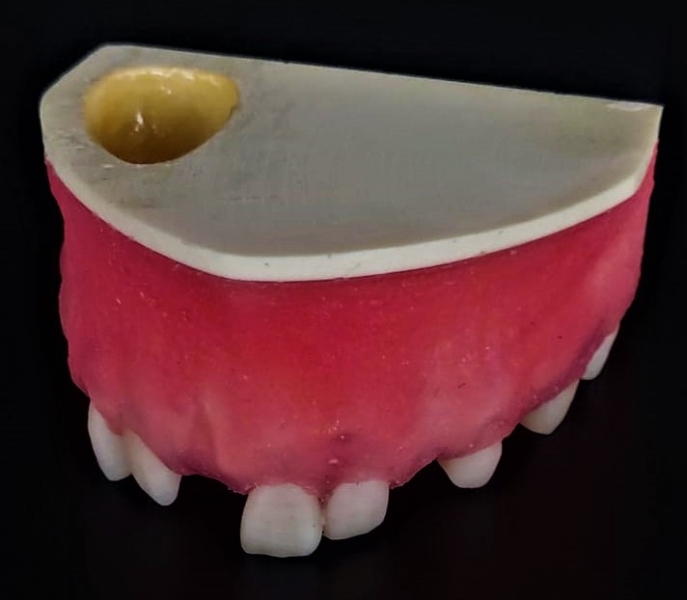 Periodontics Training Model