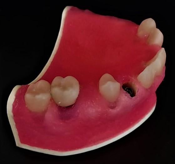 Periodontics Training Model