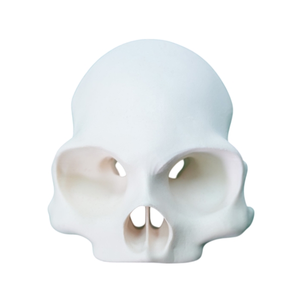 Zygoma Implant Model