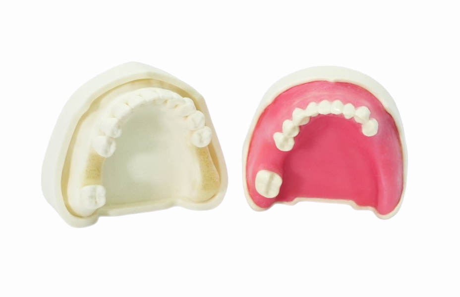 Standard Implant Model