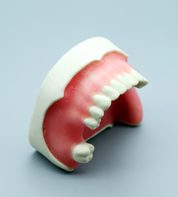 Standard Implant Model