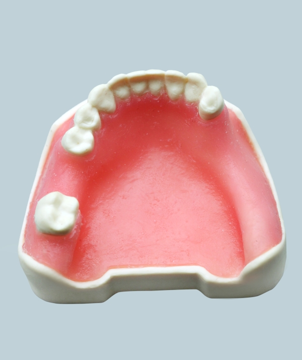 Standard Implant Model