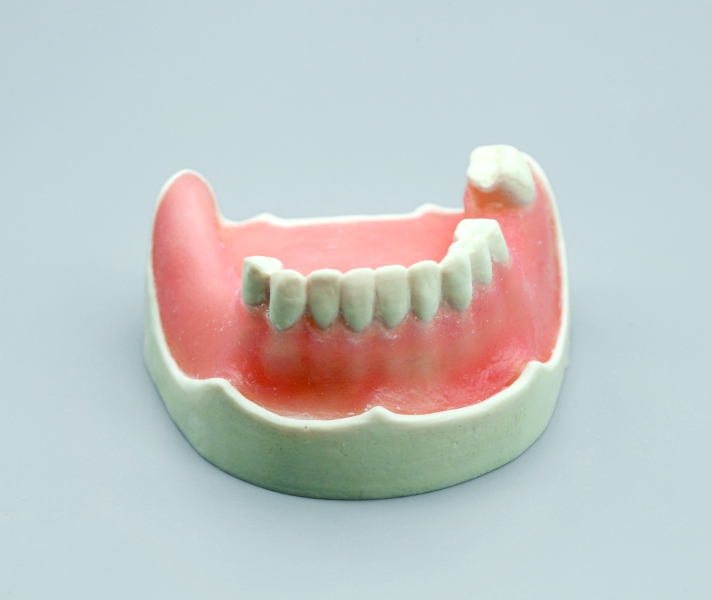 Standard Implant Model